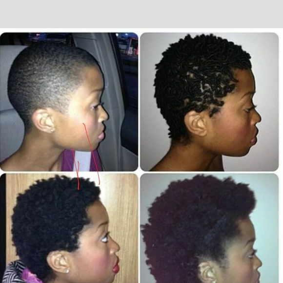 Rejuva - Picture 3 of 4